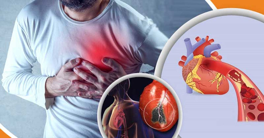 যে চার কারণে ৯৯ শতাংশ হার্ট অ্যাটাক হয়